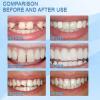 Flipped Warmth Tooth Filling Repair Kit, Temporary Tooth Repair Kit, Dental Repair Moldable False Teeth for Fixing Filling Missing Broken Tooth view 2