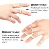 Marinada 5 PCS Trigger Finger Splint, Support and Protection for Arthritis, Finger Straightening, Mallet Finger Brace view 3