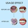 Flipped Warmth 60g Temporary Tooth Filling, Filling Kit for teeth, Tooth Repair Moldable Fake Teeth Repair Beads for Temporary Fixing Filling Missing Broken Tooth Dental view 4