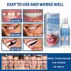 Temporary Tooth Filling,Tooth Filling Repair Kit,Tooth Repair Beads,Missing Tooth Replacement Kit,Moldable False Teeth for Fixing,Filling Missing Broken Tooth,Dental Repair Kit Filling for Fake Teeth view 2