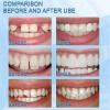 Temporary Tooth Filling,Tooth Filling Repair Kit,Tooth Repair Beads,Missing Tooth Replacement Kit,Moldable False Teeth for Fixing,Filling Missing Broken Tooth,Dental Repair Kit Filling for Fake Teeth view 3
