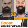 Waking Forest Biotin Beard Oil, [Bitoin Boost Beard] Beard Oil for Men Growth 2oz Sandalwood Scent Gifts for Men All Natural with Rosemary, Castor, Almond, Vitamin B7 view 3