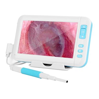 TsoLay 3.9MM Video Otoscope Camera, 4.5 Inch Ear Endoscope with 2000 MAh Battery, 6 High Brightness LED Lights, 32GB Card Supports Photo and Video Recording, for Kids, Adults, Pets