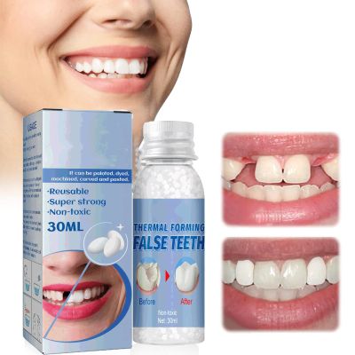 Wttfc Tooth Repair Granules, Tooth Filling Repair Kit, DIY Moldable False Teeth - Temporary Tooth Repair Beads, Tooth Filling Replacement Kit for Fix The Missing and Broken Tooth, 60g
