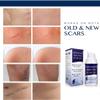 Silicone Scar Gel, Advanced Scar Gel for Surgical Scars, C-Section, Stretch Marks, Acne, Injury, Burns, Old and New Scars view 2