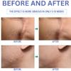 Silicone Scar Gel, Advanced Scar Gel for Surgical Scars, C-Section, Stretch Marks, Acne, Injury, Burns, Old and New Scars view 4