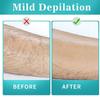 Crystal Hair Eraser for Women and Men, Reusable Crystal Hair Remover Device Magic Painless Exfoliation Hair Removal Tool, Magic Hair Eraser for Back Arms Legs (Diamond) view 2