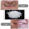 Flipped Warmth Moldable False Teeth Tooth Repair Granules, Teeth Repair Kit, DIY Temporary Tooth Repair Beads, for Temporary Fixing The Missing And Broken Tooth Replacements,3pcs view 4