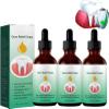 EXQST Dentizen Drops Dentizen Gum Regrowth Drops 30ml Gum Regrowth Treatment Drops Gum Repair Treatment Drops Repair Gum Regrowth for Receding Gum view 1