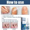 3 Pcs Furzero Athletes Foot Treatment Spray, Furzero Medical Grade Nail Foot Spray, Foot Fungus Treatment Spray Nail Repair Spray view 3