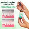 Gum Regrowth Drops | Gum Repair for Receding Gums | 30ml Gum Repair Gel Gum Regrowth Oral Care Drops for Receding Gums, Gum Repair Regrowth view 2
