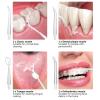 BODYA 220ml Electric Waterproof Cordless Water Flosser Dental Oral Irrigator Teeth Cleaner with 4 Jet Tips, 3 Pressure Mode (White) view 4