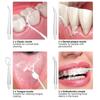 BODYA 220ml Electric Waterproof Cordless Water Flosser Dental Oral Irrigator Teeth Cleaner with 4 Jet Tips, 3 Pressure Mode (Pink) view 4
