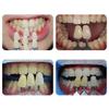 29 Colors Teeth Whitening Shade Guide Professional 3D Tooth Bleaching Shade Chart view 2