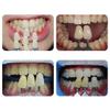 3D Master Dental Lab Bleach Shade Guide 29 Colors Teeth Whitening Comparing Toothguide Dentistry Clinic Colorimetric Plate view 2