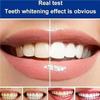 SP-Y6 Toothpaste, SP-Y6 Beneficial Bacteria Whitening Mouth Plaster, Brightening & Stain Removing Toothpaste, 100g (3pcs) view 3