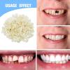70PCS Temporary Tooth Crown,Temporary Crowns for Teeth,Tooth Repair Kit,Dental Temporary Tooth Cap Crown,Front Fake Teeth,Tooth Crown,False Tooth Replacement,Temporary Crown for Tooth Repair view 3