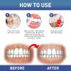 ATTDX Gum Instant Treatment Gel Attdx Teeth Whitening Cleansing Serum Pen Gum Disease Treatment Promotes Gum Health view 3