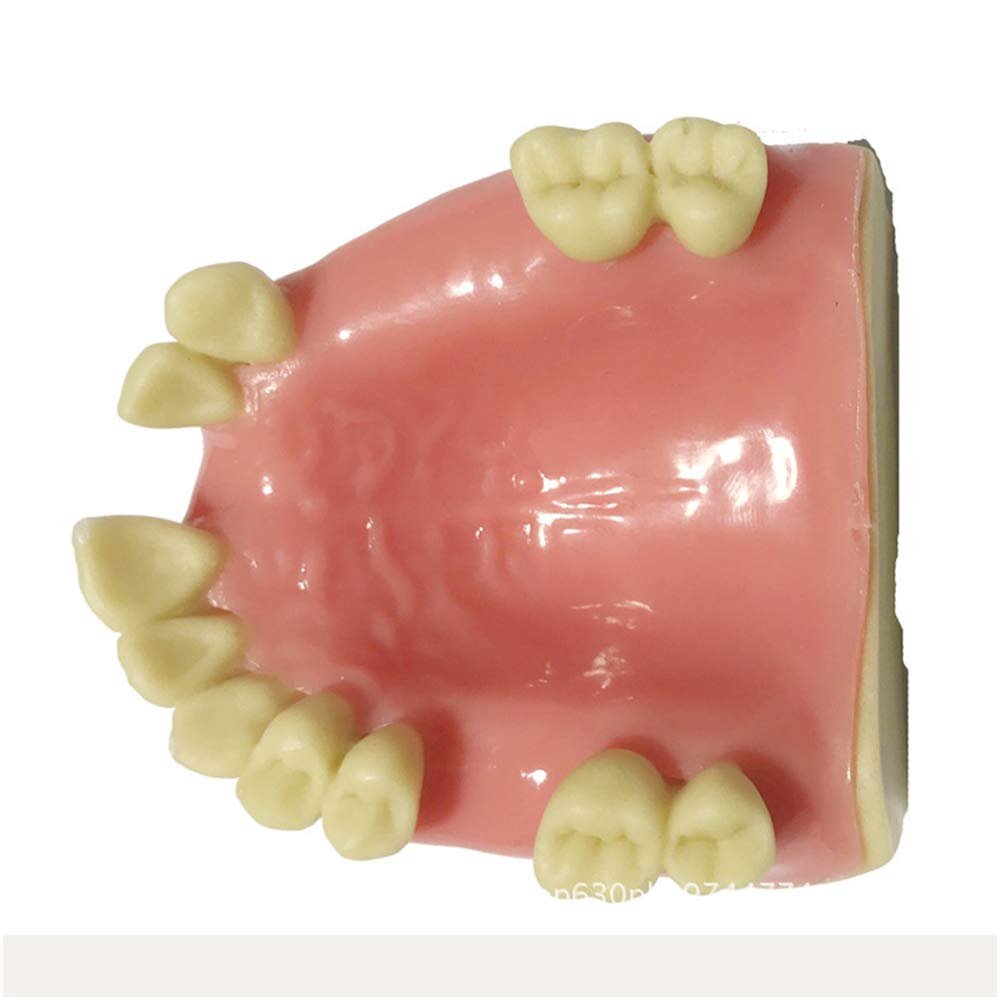 ERNZI Teeth Teach Model GMaxillary Missing Dental Model GDental Teeth Teach Teaching Pattern GSimulation Oral Teeth.
