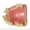 ERNZI Teeth Teach Model GMaxillary Missing Dental Model GDental Teeth Teach Teaching Pattern GSimulation Oral Teeth. view 1
