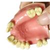 ERNZI Teeth Teach Model GMaxillary Missing Dental Model GDental Teeth Teach Teaching Pattern GSimulation Oral Teeth. view 2