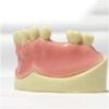 ERNZI Teeth Teach Model GMaxillary Missing Dental Model GDental Teeth Teach Teaching Pattern GSimulation Oral Teeth. view 3