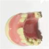 ERNZI Teeth Teach Model GMaxillary Missing Dental Model GDental Teeth Teach Teaching Pattern GSimulation Oral Teeth. view 4