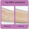 VIDECOR Crystal Hair Eraser for Women and Men, Reusable Crystal Hair Remover Device Magic Painless Exfoliation Hair Removal Tool, Magic Hair Eraser for Back Arms Legs,F view 3