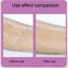 VIDECOR Crystal Hair Eraser for Women and Men, Reusable Crystal Hair Remover Device Magic Painless Exfoliation Hair Removal Tool, Magic Hair Eraser for Back Arms Legs,D view 3