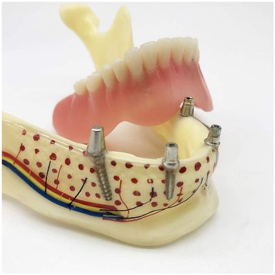 ERNZI Teeth Lower Jaw Teeth Study Model Simulated Oral Tooth Bone Lower Jaw Model Teeth With Teeth Chewing Gum For Classroom Study Display