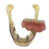 ERNZI Teeth Lower Jaw Teeth Study Model Simulated Oral Tooth Bone Lower Jaw Model Teeth With Teeth Chewing Gum For Classroom Study Display view 3