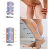 2 Pairs Medical Compression Socks for Women & Men 20-30 mmHg, class 2, Open Toe Best Graduated Support Fit for Travel Flight Running Varicose Veins Pregnancy Nurses (Black+Beige, M) view 3