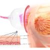 Electric Breast Massager, Chest Beauty Enlargement Machine, Vacuum Pump Enhancing Double Cup To Promote Breast Growth Sutible, Double Cup view 4