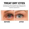 ATTDX Treatment EyeProblems SolutionDrops, ATTDX Eye Therapy Drops, ATTDX Drops for Itchy and Dry Eye Relief,ATTDX Treatment Eye Problem,Promote Healthy Vision (2PC) view 3