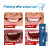 Glowbrite - Glowbrite Teeth Whitening Pen 3-Day Whitening Teeth Whitening Essence Pen Sensitive Teeth and Gums Teeth Whitening view 3