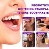 2023 New Sp-7 Probiotic Whitening Toothpaste, Brightening & Stain Removing Toothpaste, SP-7 Natural Tooth Whitener, Removes Tooth Stains, Fresh Breath, 120g (2pcs) view 3