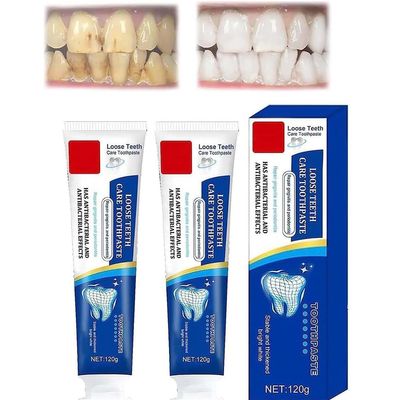 Consentbil Repair Toothpaste,Ginseng Propolis Conservation Toothpaste,Loose Teeth Toothpaste, Deep Cleaning Care Toothpaste,Loose Teeth Repair, Teeth Whitening Fresh Breath (2pcs)