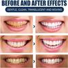 Teeth Whitening, Natural Teeth Whitening Powder, Activated Coconut Charcoal Powder Teeth Whitening, 50g (1pcs) view 4