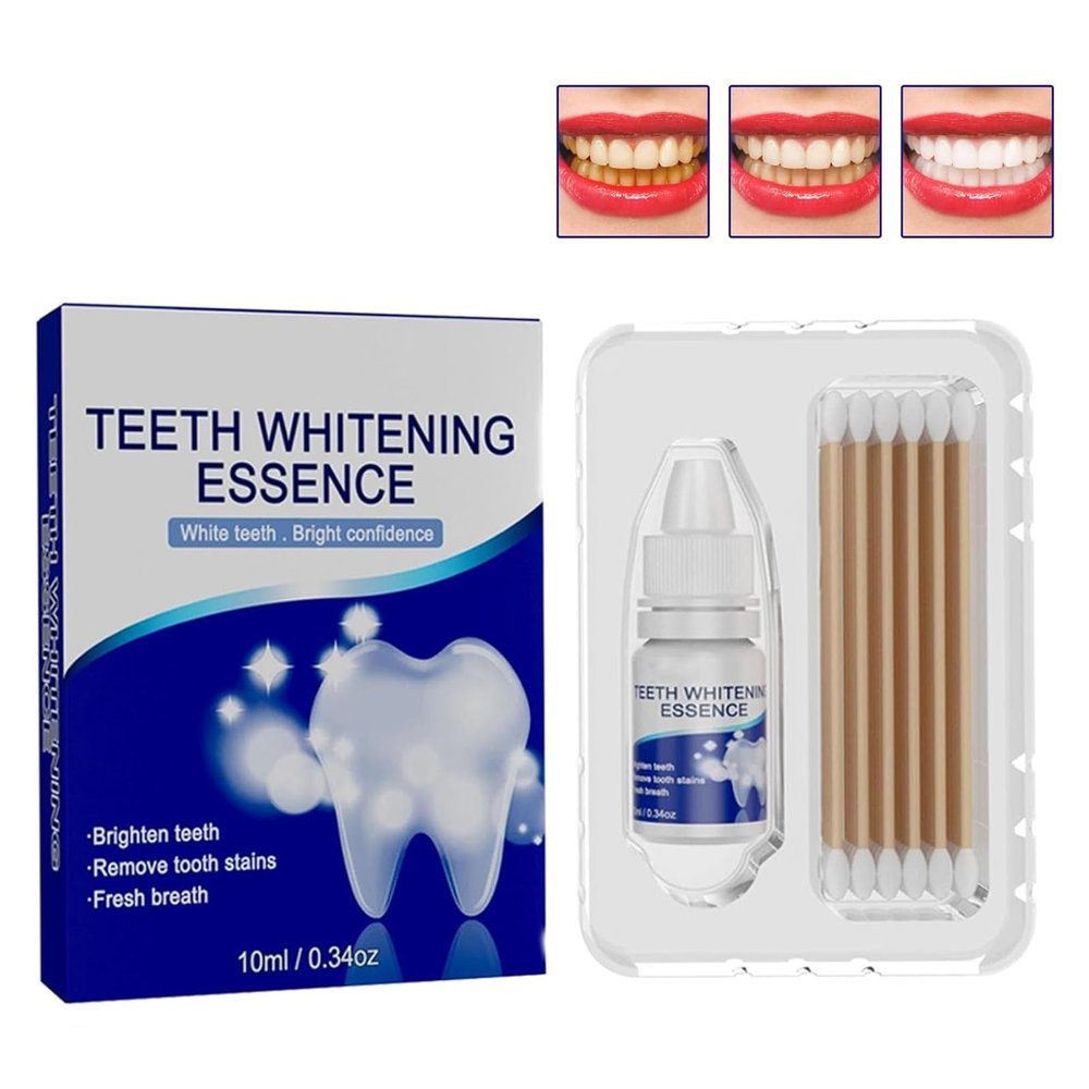 GFOUK Essence Teeth Whitening Kit - Professional Home Whitening System,Teeth whitening kit, Home whitening System, Professional Teeth whitening, GFOUK Essence (1PC)
