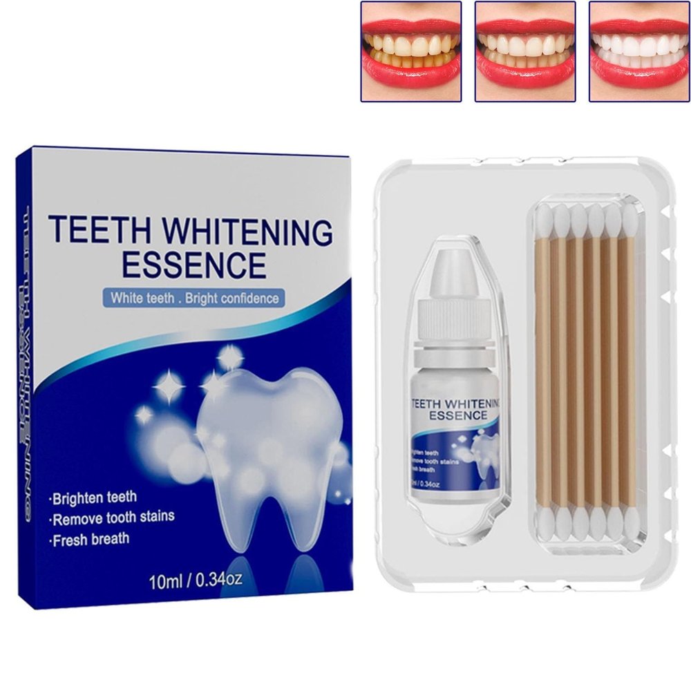 PureSmile Essence Teeth Whitening Essence Kit Teeth Whitening Kit Professional Home Whitening System Maintain Oral Health