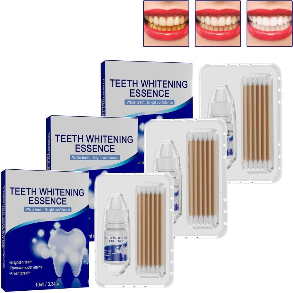 PureSmile Essence Teeth Whitening Essence Kit Teeth Whitening Kit Professional Home Whitening System Maintain Oral Health