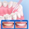 EUPSIIU 70 Pieces Interdental Brush, 0.6mm Interdental Pick Brushes Retractable Floss Head Toothbrush, 0.7mm Portable Tooth Cleaner Toothpicks Dental Floss for Cleaning Gaps Between Teeth (2 Colors) view 3