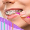 50pcs Braces Brush & Floss Picks Kit - Interdental Cleaning Tool for Teeth with Braces view 3