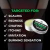Jock Itch Cream for Men  Antifungal Treatment for Groin, Itching, & Rash | Strong Jock Itch Relief Balm | Natural Antifungal Skin Cream (30ml)  Made in UK view 2