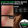 Jock Itch Cream for Men  Antifungal Treatment for Groin, Itching, & Rash | Strong Jock Itch Relief Balm | Natural Antifungal Skin Cream (30ml)  Made in UK view 4