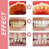 BioDental Harmony Toothpaste BioDental Probiotic Whitening Toothpaste freshens Breath and removes Stains view 3