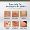 ScarErase Advanced Removal Spray, Advanced Scar Spray for All Types of Scars, for All Types of Scars, Surgical Scars and Stretch Marks, Scar Removal Spray (1PC) view 4