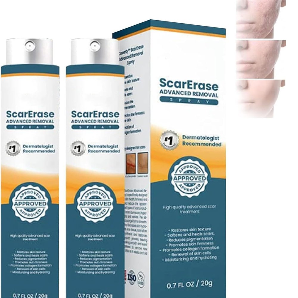 Advanced Scar Spray, Scar Removal Spray, Pregnancy Stretch Mark Spray, Advanced Acne Scar Treatment for Face, Acne Scar and Dark Spot Remover