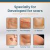 Advanced Scar Spray, Scar Removal Spray, Pregnancy Stretch Mark Spray, Advanced Acne Scar Treatment for Face, Acne Scar and Dark Spot Remover view 4