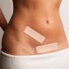 JINGAN Scar Stickers | Soft and Flexible Silicone Scar Removing Tapes,Tummy Tuck Scars Removal Sheets for Traveling, Beach Vacation, Business Trips, Home, Working view 2